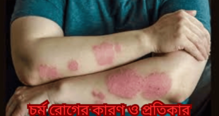 চর্ম রোগের কারণ ও প্রতিকার